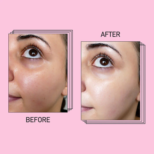 Skin Whitening Face Pack