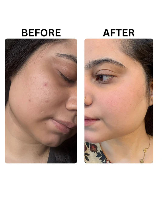 Skin Whitening Vit-C Pack