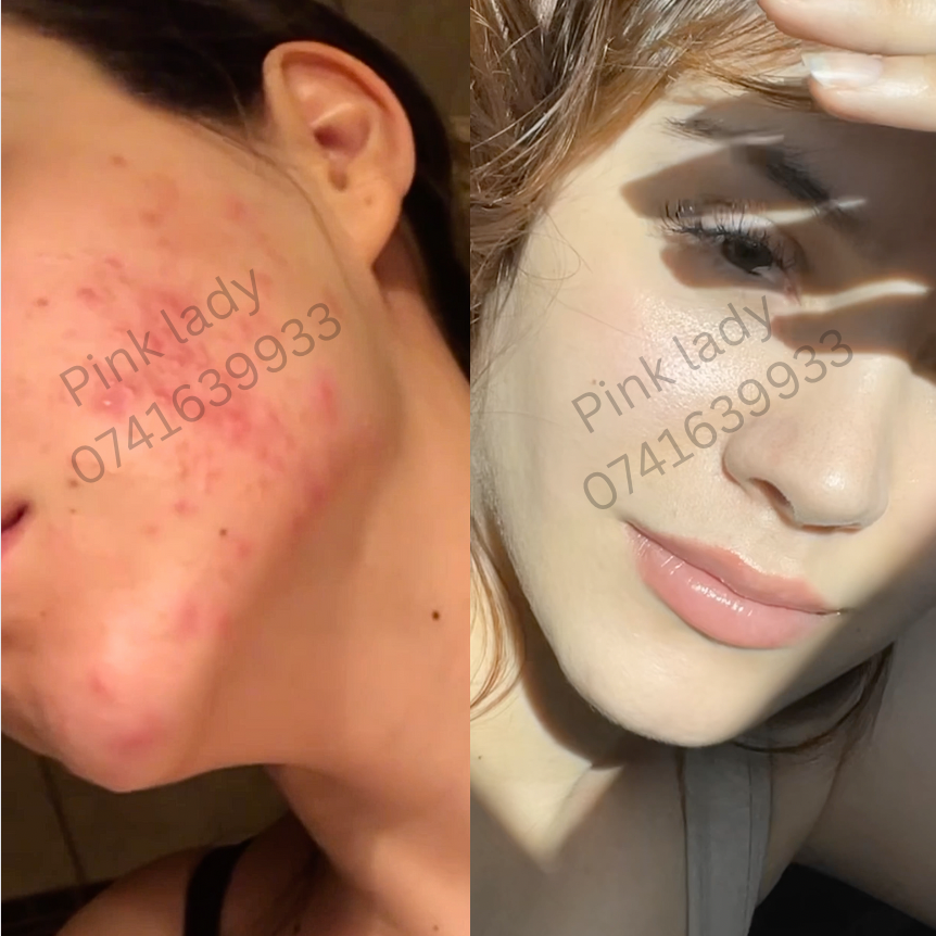 Pinkish Double Whitening Face Night Cream