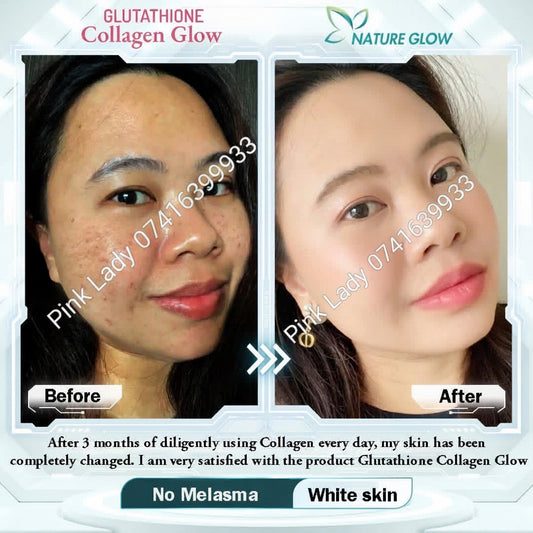 Glutathione Collagen Glow
