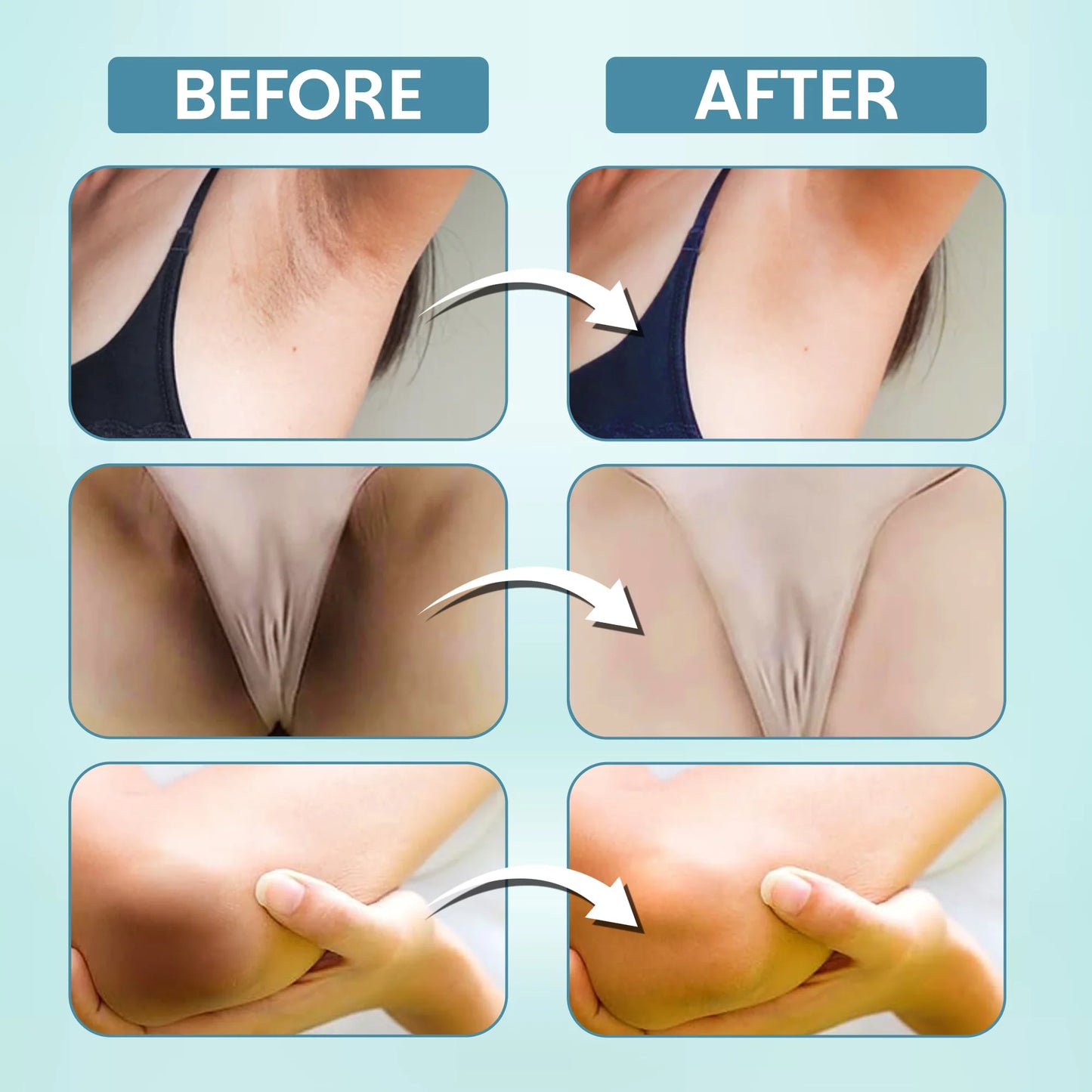 Underarm & Bikini Whitening Cream