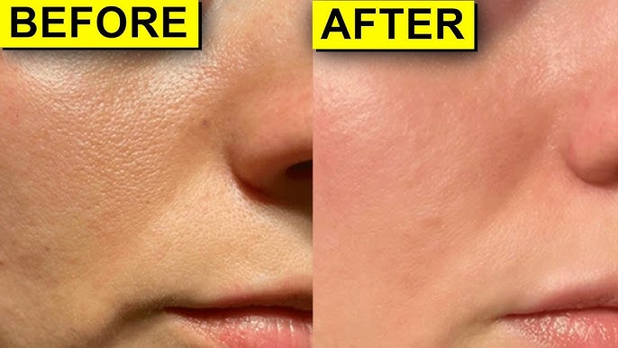 High - Strength Glow Toner
