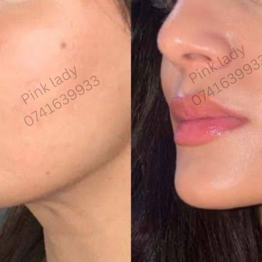 Pinkish Face Serum 2 X Fast Whitening